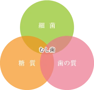 むし歯の原因 むし歯の原因