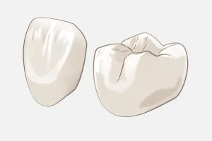 セラミッククラウン セラミッククラウン