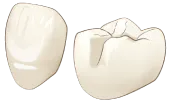 セラミック