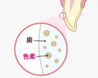 1.歯の色が黄色い状態