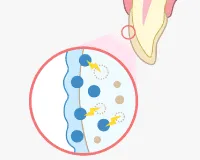2.ホワイトニング剤を塗布