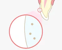 3.歯が白く美しく変身!