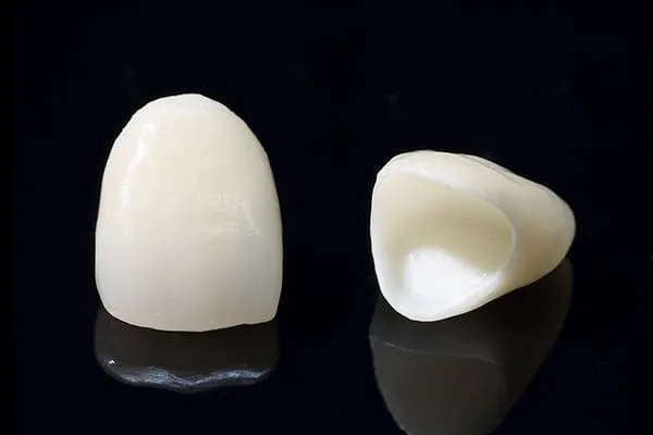 zir_cera_up1のコピー セラミックという素材とメタルフリー治療